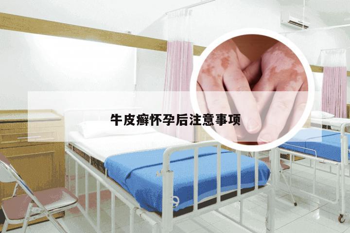 牛皮癣怀孕后注意事项
