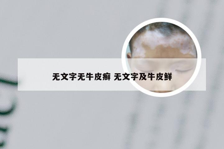 无文字无牛皮癣 无文字及牛皮鲜