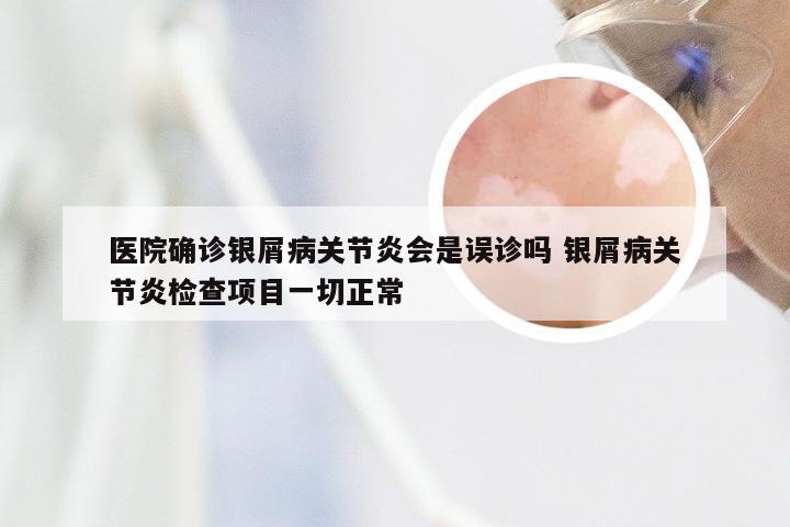 医院确诊银屑病关节炎会是误诊吗 银屑病关节炎检查项目一切正常