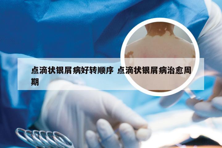点滴状银屑病好转顺序 点滴状银屑病治愈周期