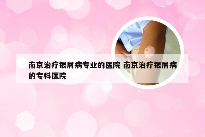 南京治疗银屑病专业的医院 南京治疗银屑病的专科医院