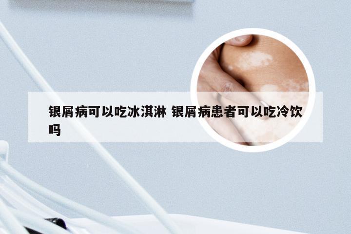 银屑病可以吃冰淇淋 银屑病患者可以吃冷饮吗