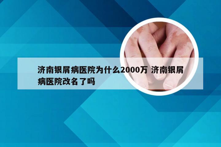 济南银屑病医院为什么2000万 济南银屑病医院改名了吗