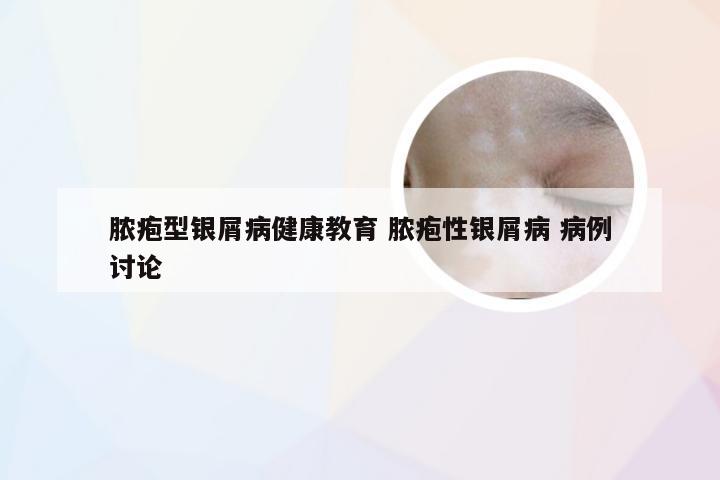 脓疱型银屑病健康教育 脓疱性银屑病 病例讨论