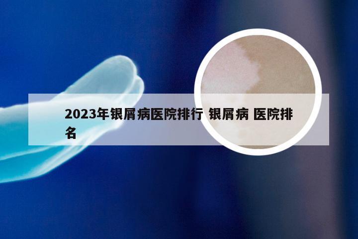 2023年银屑病医院排行 银屑病 医院排名