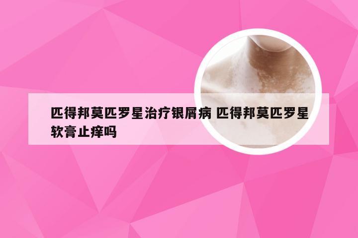 匹得邦莫匹罗星治疗银屑病 匹得邦莫匹罗星软膏止痒吗