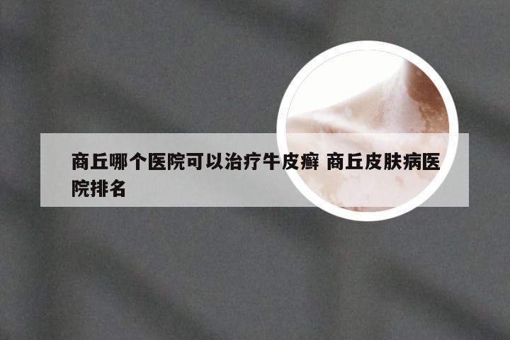 商丘哪个医院可以治疗牛皮癣 商丘皮肤病医院排名