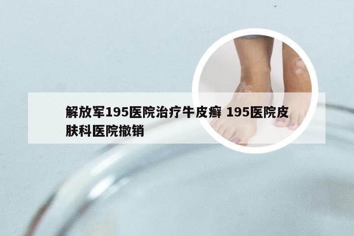 解放军195医院治疗牛皮癣 195医院皮肤科医院撤销