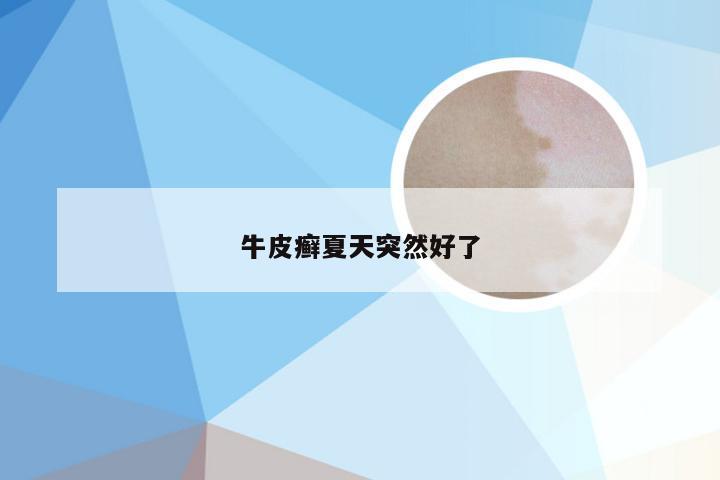 牛皮癣夏天突然好了