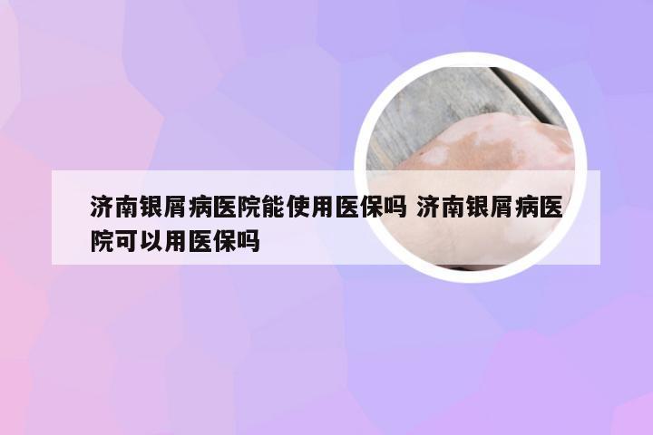 济南银屑病医院能使用医保吗 济南银屑病医院可以用医保吗