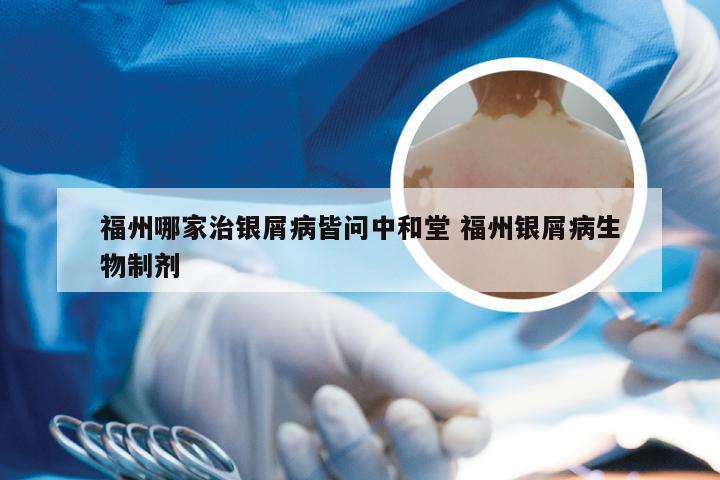 福州哪家治银屑病皆问中和堂 福州银屑病生物制剂