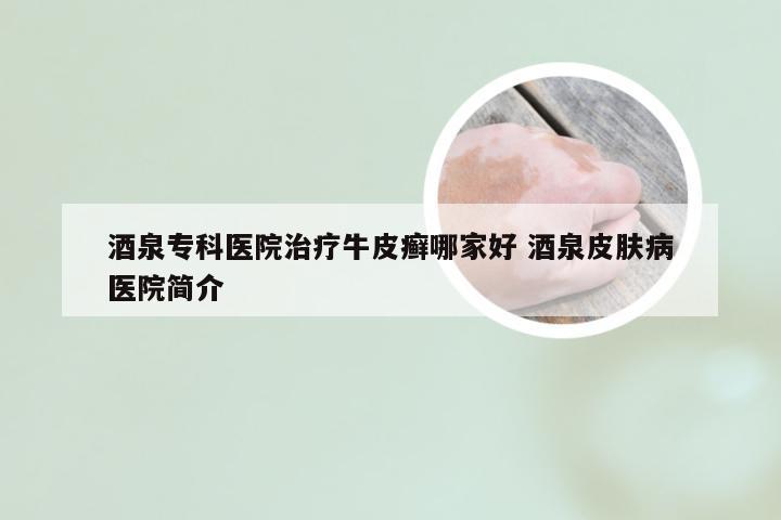 酒泉专科医院治疗牛皮癣哪家好 酒泉皮肤病医院简介