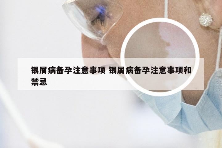 银屑病备孕注意事项 银屑病备孕注意事项和禁忌