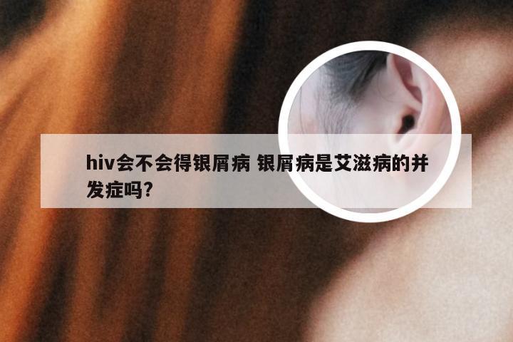 hiv会不会得银屑病 银屑病是艾滋病的并发症吗?