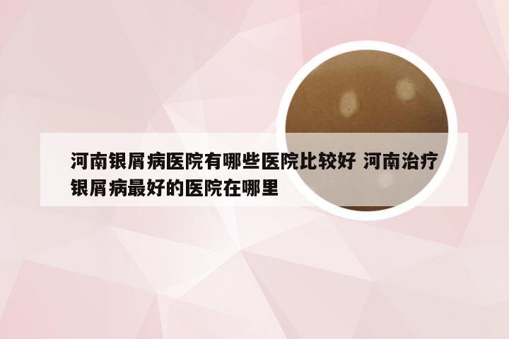 河南银屑病医院有哪些医院比较好 河南治疗银屑病最好的医院在哪里