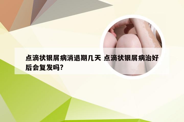 点滴状银屑病消退期几天 点滴状银屑病治好后会复发吗?