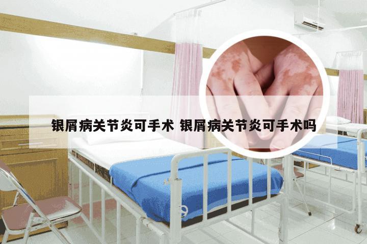 银屑病关节炎可手术 银屑病关节炎可手术吗