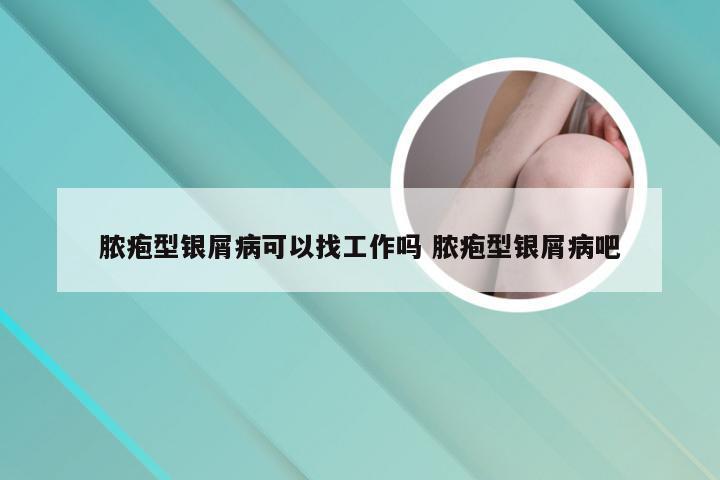 脓疱型银屑病可以找工作吗 脓疱型银屑病吧