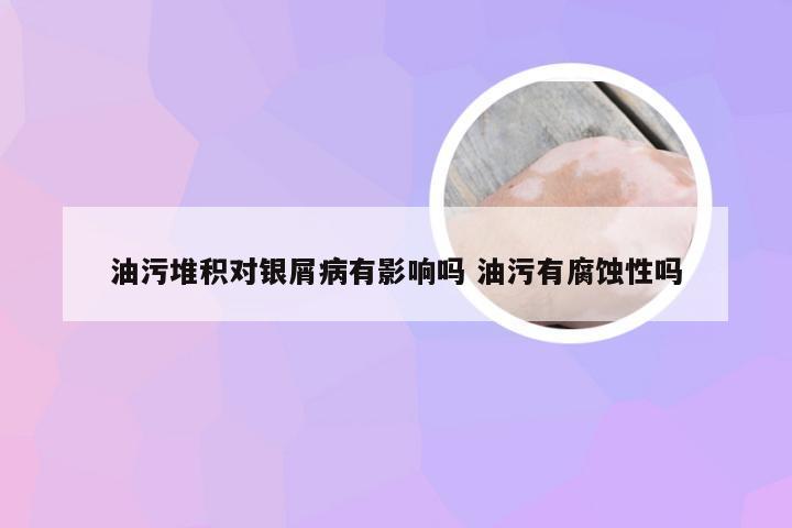 油污堆积对银屑病有影响吗 油污有腐蚀性吗