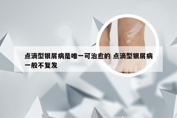 点滴型银屑病是唯一可治愈的 点滴型银屑病一般不复发