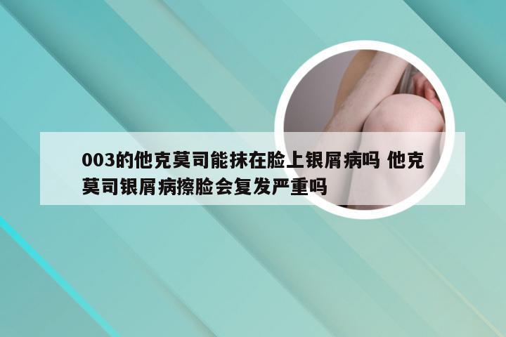 003的他克莫司能抹在脸上银屑病吗 他克莫司银屑病擦脸会复发严重吗