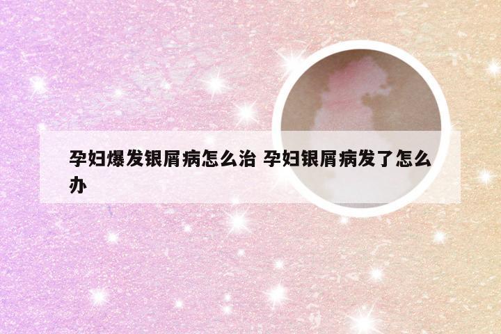 孕妇爆发银屑病怎么治 孕妇银屑病发了怎么办