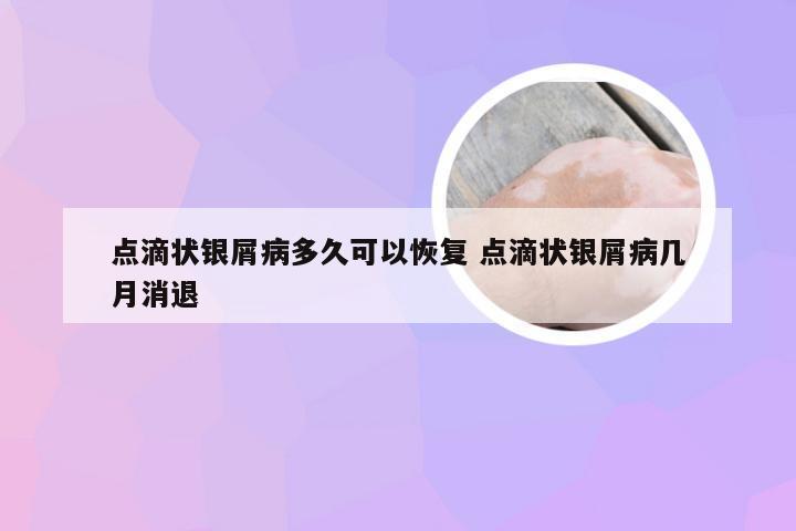 点滴状银屑病多久可以恢复 点滴状银屑病几月消退