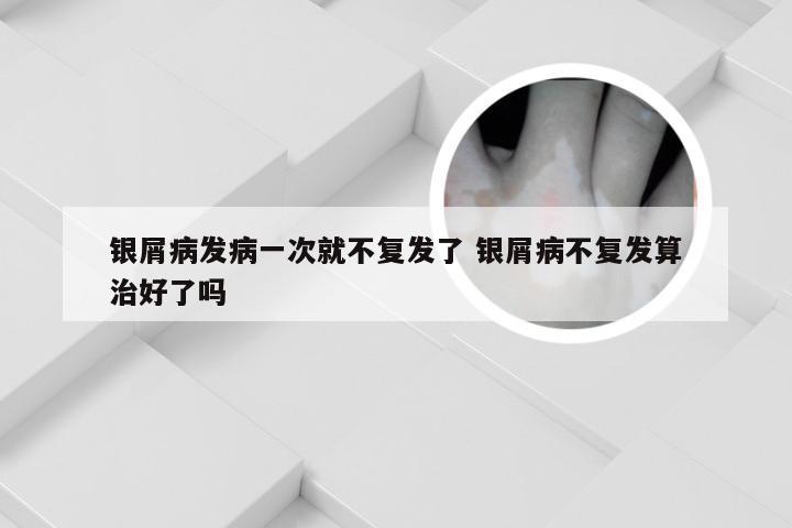 银屑病发病一次就不复发了 银屑病不复发算治好了吗