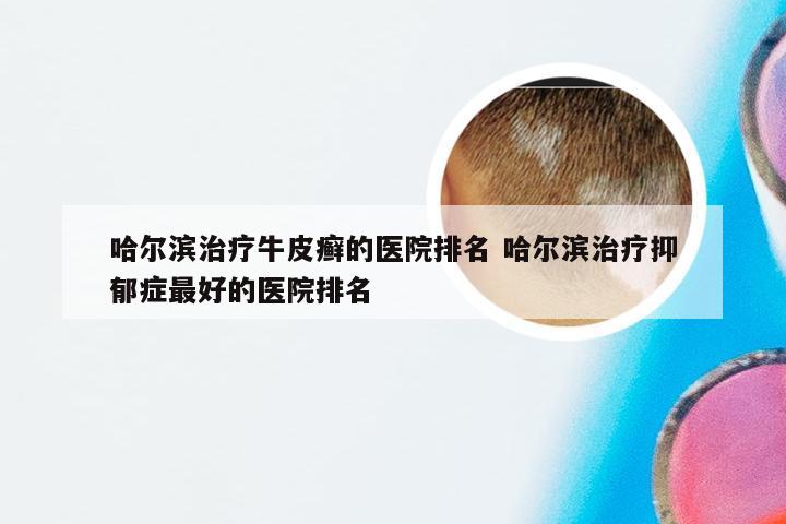 哈尔滨治疗牛皮癣的医院排名 哈尔滨治疗抑郁症最好的医院排名