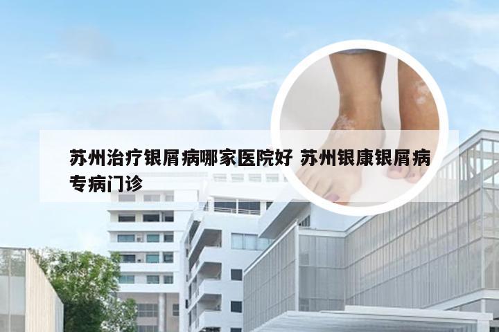 苏州治疗银屑病哪家医院好 苏州银康银屑病专病门诊