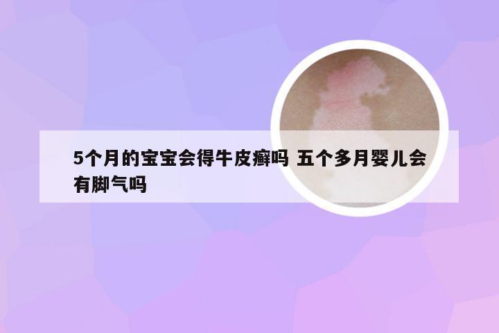 5个月的宝宝会得牛皮癣吗 五个多月婴儿会有脚气吗