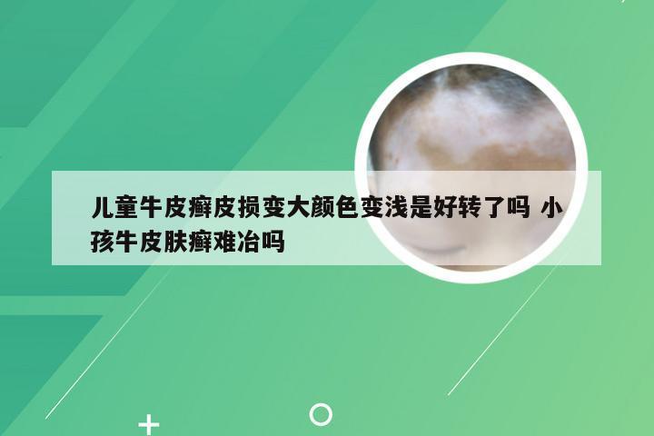 儿童牛皮癣皮损变大颜色变浅是好转了吗 小孩牛皮肤癣难冶吗