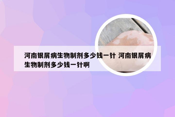 河南银屑病生物制剂多少钱一针 河南银屑病生物制剂多少钱一针啊