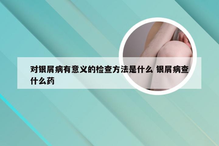 对银屑病有意义的检查方法是什么 银屑病查什么药