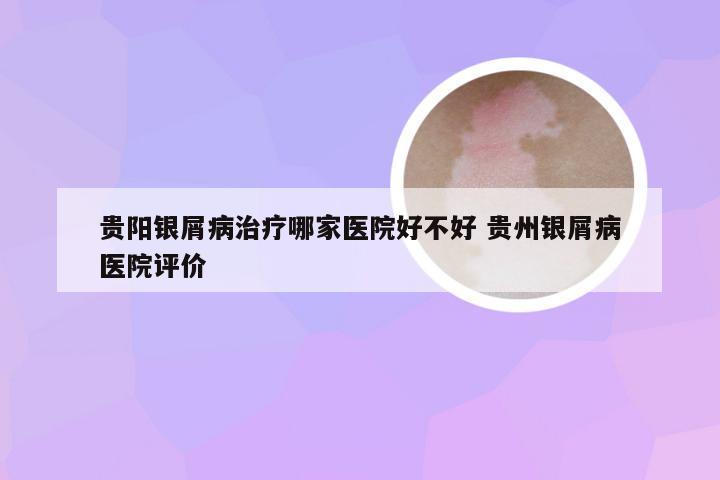 贵阳银屑病治疗哪家医院好不好 贵州银屑病医院评价