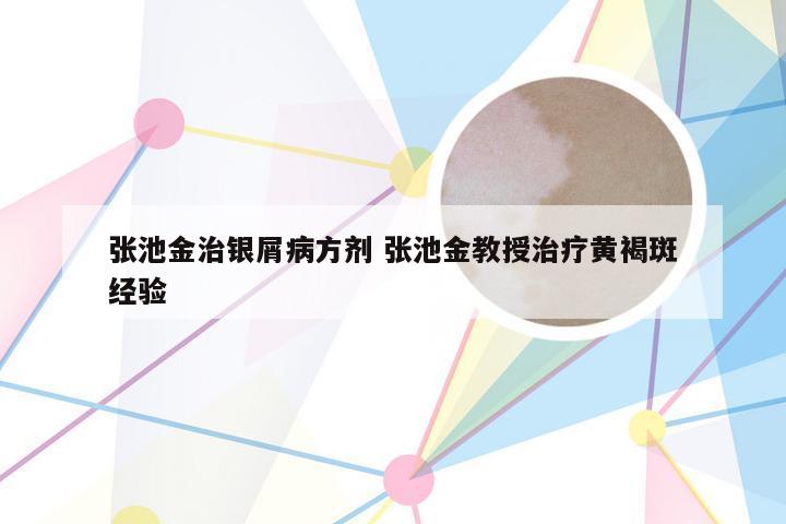 张池金治银屑病方剂 张池金教授治疗黄褐斑经验