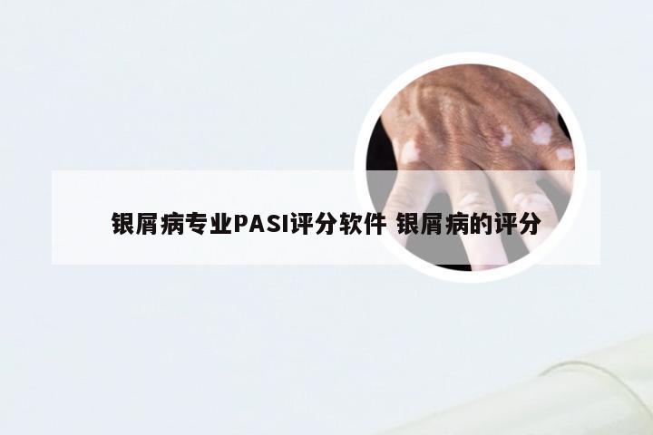 银屑病专业PASI评分软件 银屑病的评分