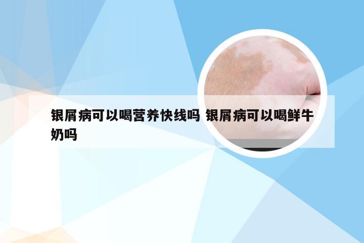 银屑病可以喝营养快线吗 银屑病可以喝鲜牛奶吗