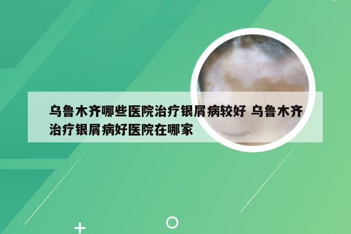 乌鲁木齐哪些医院治疗银屑病较好 乌鲁木齐治疗银屑病好医院在哪家