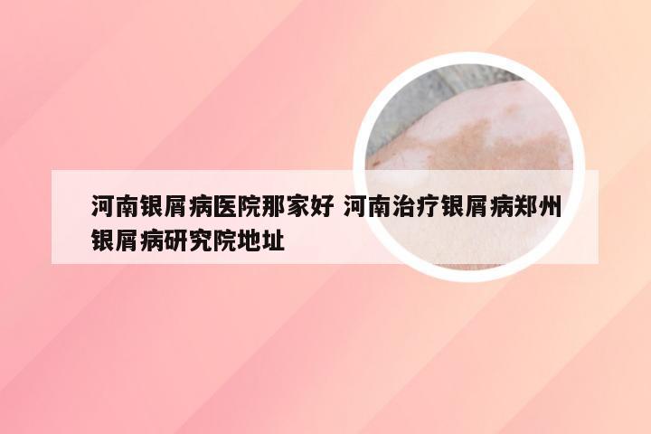 河南银屑病医院那家好 河南治疗银屑病郑州银屑病研究院地址