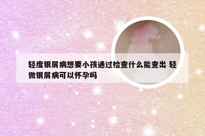 轻度银屑病想要小孩通过检查什么能查出 轻微银屑病可以怀孕吗