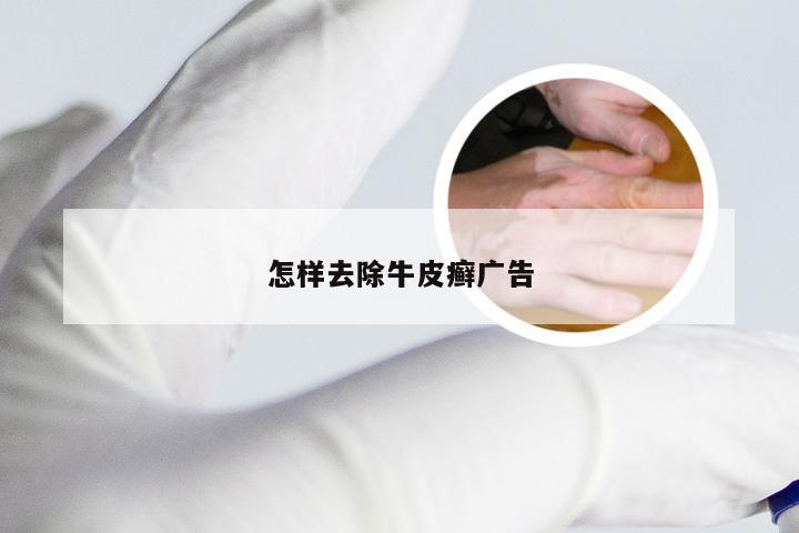 怎样去除牛皮癣广告