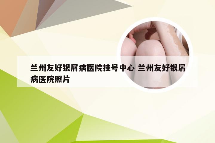 兰州友好银屑病医院挂号中心 兰州友好银屑病医院照片