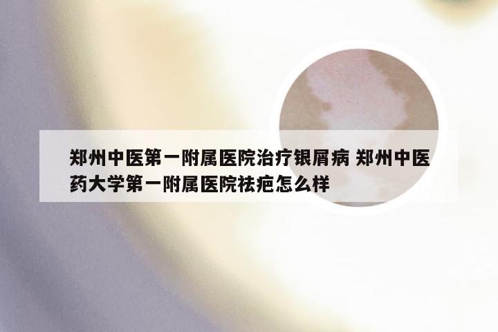 郑州中医第一附属医院治疗银屑病 郑州中医药大学第一附属医院祛疤怎么样
