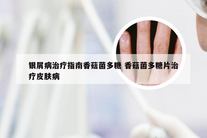 银屑病治疗指南香菇菌多糖 香菇菌多糖片治疗皮肤病