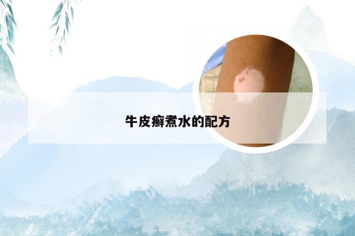 牛皮癣煮水的配方