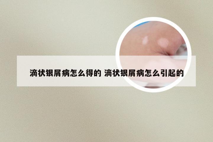 滴状银屑病怎么得的 滴状银屑病怎么引起的