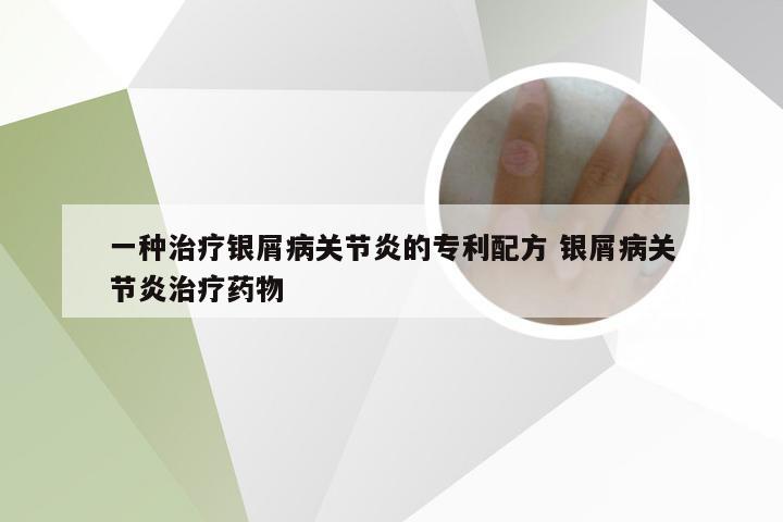 一种治疗银屑病关节炎的专利配方 银屑病关节炎治疗药物