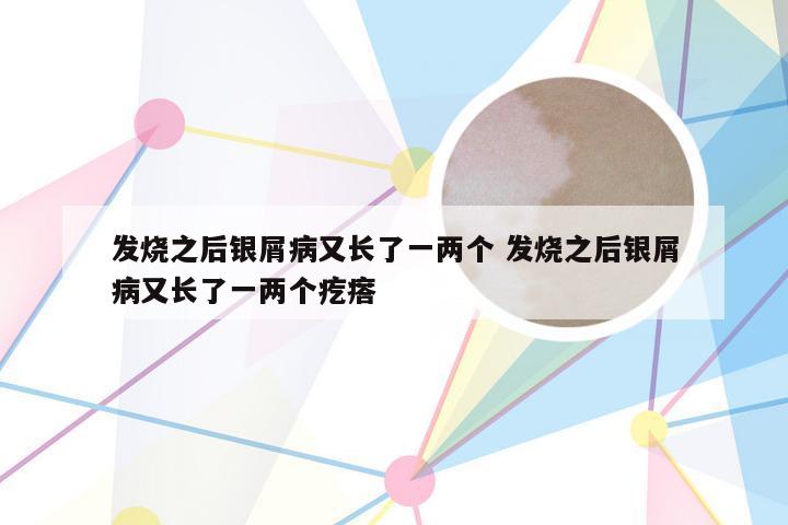 发烧之后银屑病又长了一两个 发烧之后银屑病又长了一两个疙瘩