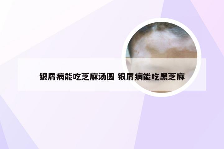 银屑病能吃芝麻汤圆 银屑病能吃黑芝麻